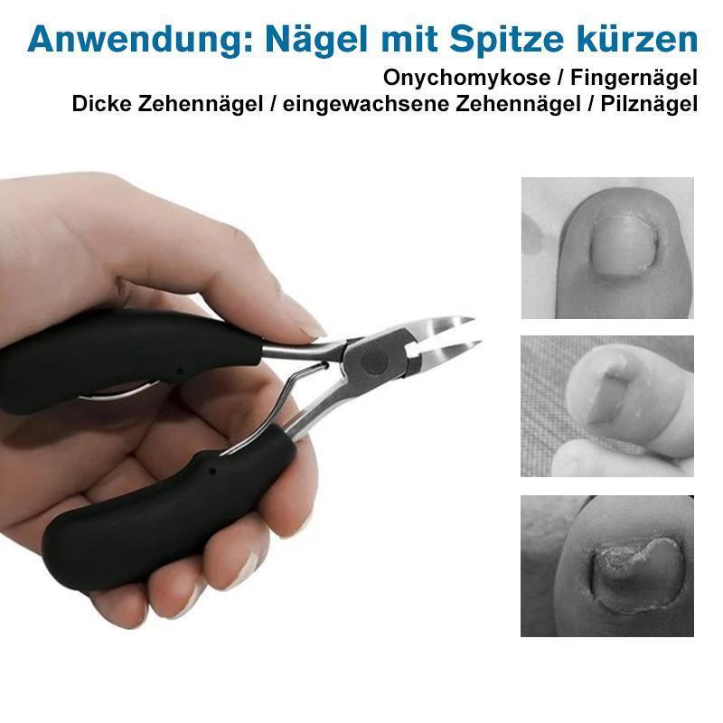 Avelena | 304 Edelstahl Nagelknipser-Set, Vorbeugung von Paronychie, Pilzinfektion