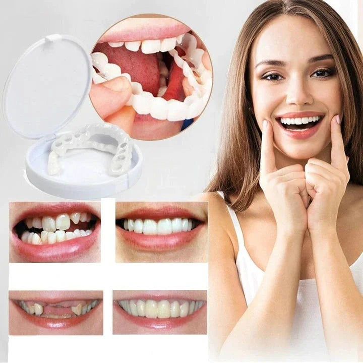 Avelena | Sofortige Lächelverwandlung mit Snap on Smile Veneers