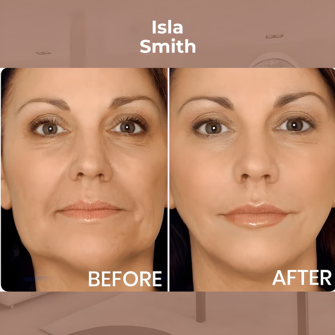 Avelena | StraffPflaster Anti-Aging Kraft