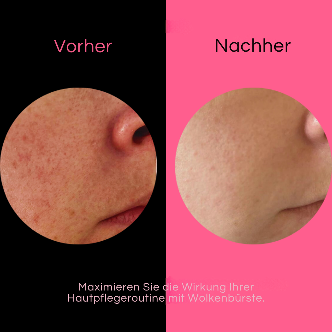 Avelena | Wolkenbürste Ultrasanftes Peeling