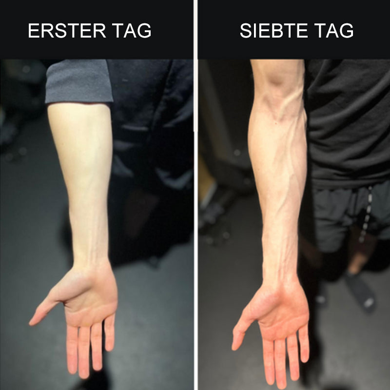 Avelena | Silikon-Fingerübungstrainer