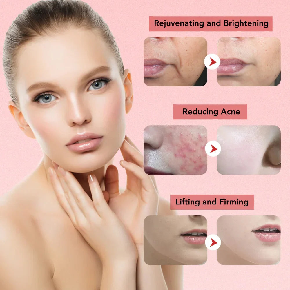 Avelena | Aetheris™ | Ultraschall-Hautstraffungswerkzeug | Gesichtsformungsgerät für Anti-Aging & Hautstraffung