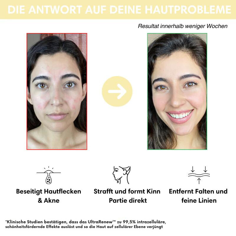 Avelena | VerjüngungsKur Nacken- und Gesichtsmassagegerät