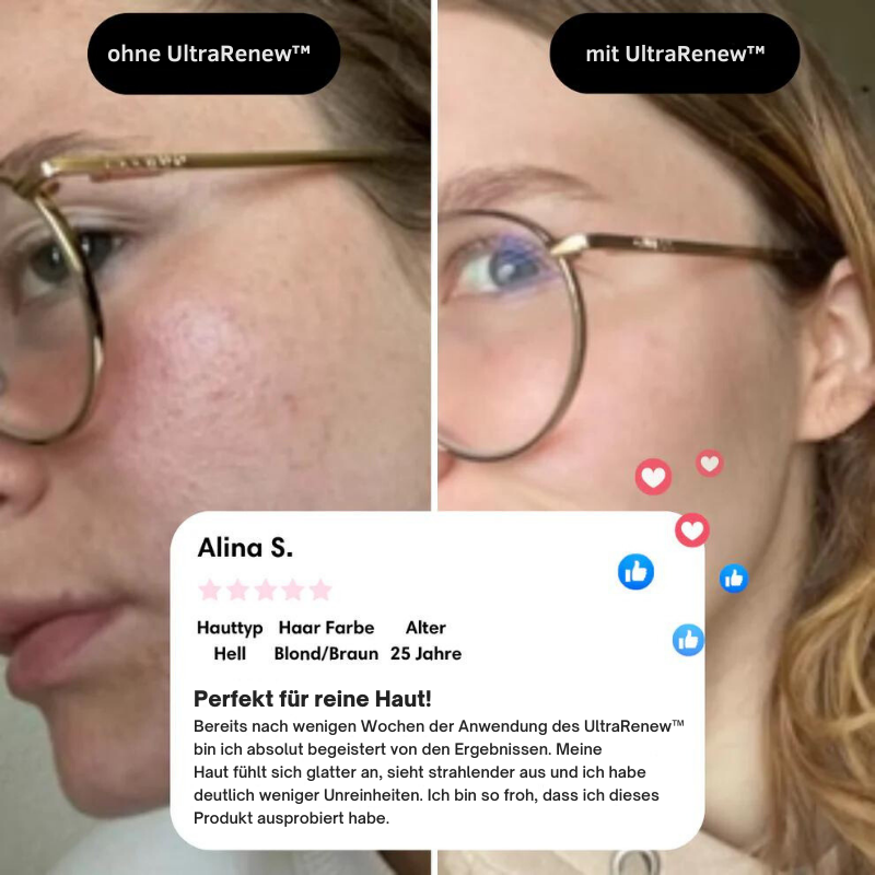 Avelena | VerjüngungsKur Nacken- und Gesichtsmassagegerät