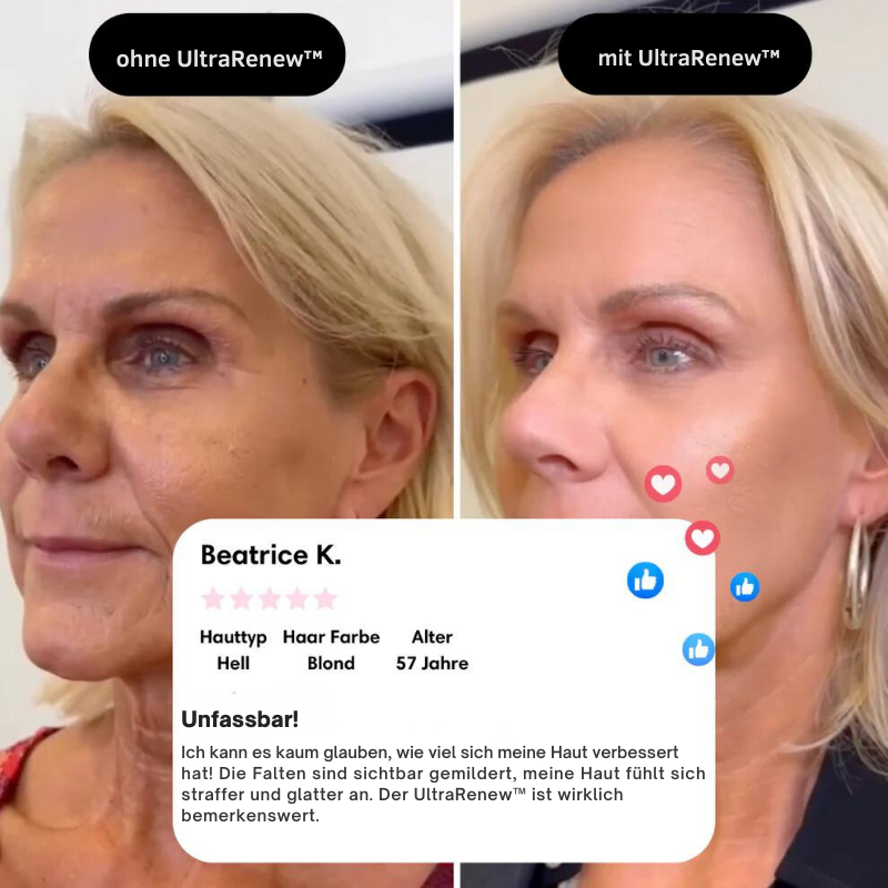 Avelena | VerjüngungsKur Nacken- und Gesichtsmassagegerät