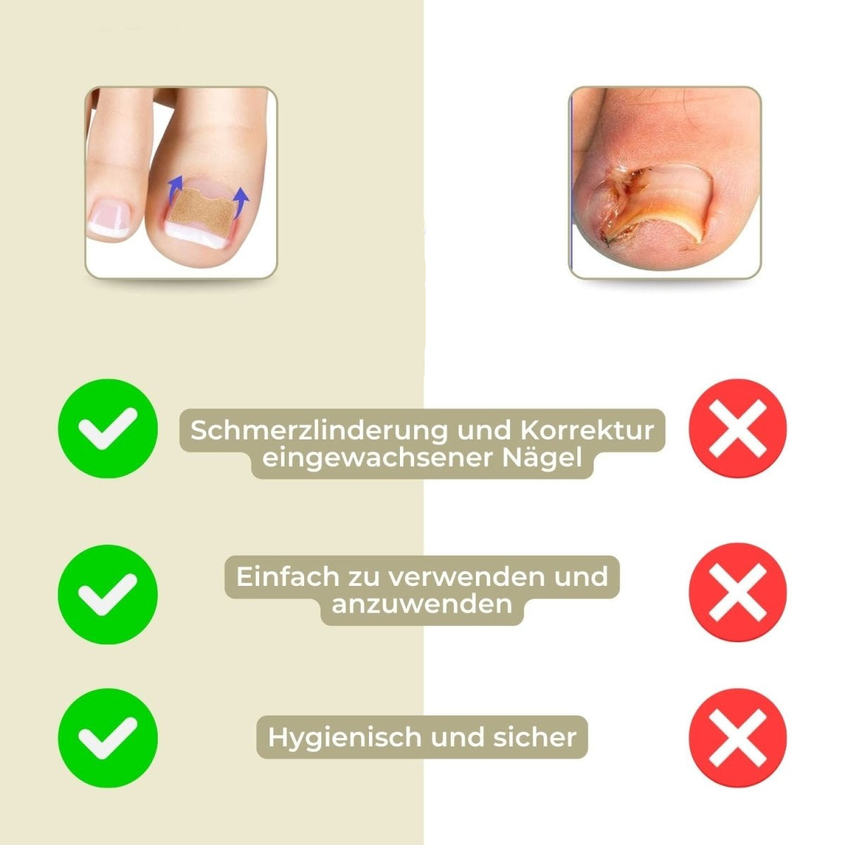 Avelena | ALIGNSTRIP – Schmerzfreie Nagelkorrekturstreifen für eingewachsene und deformierte Nägel