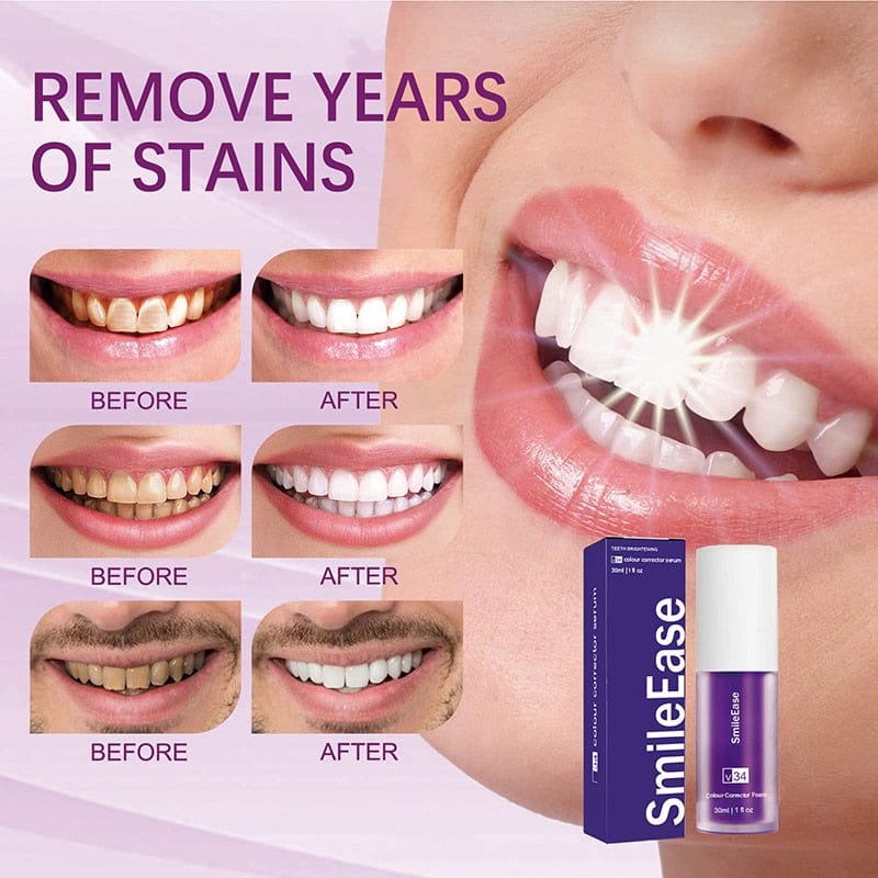 Avelena | AufhellenPro Ultimative Whitening-Formel in nur wenigen Wochen