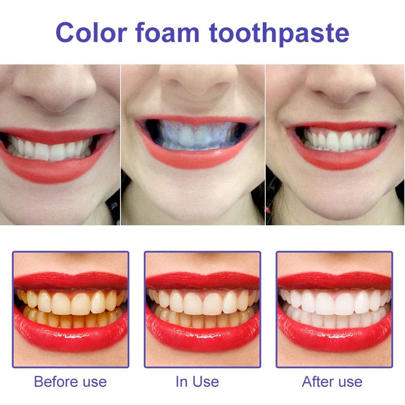 Avelena | AufhellenPro Ultimative Whitening-Formel in nur wenigen Wochen