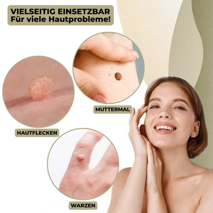 Avelena | Clarina SkinClear | Warzen- & Muttermalentferner | Sanft & Effektiv | Für Gesicht & Körper