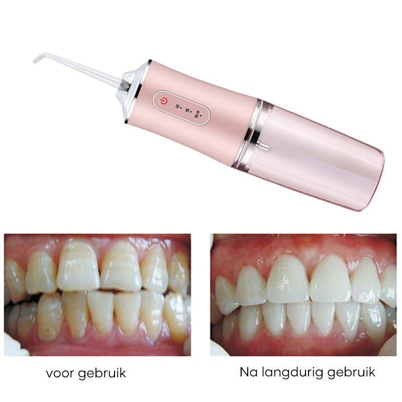 Avelena | Dental Wasser Flosser