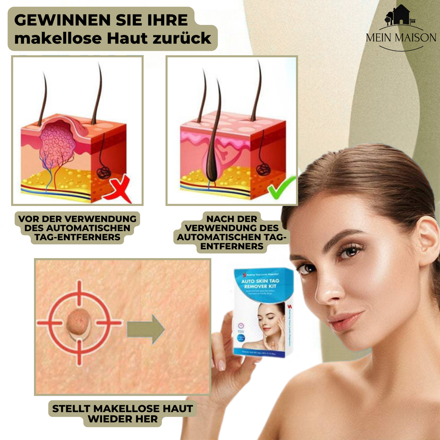 Avelena | Clarina SkinClear | Warzen- & Muttermalentferner | Sanft & Effektiv | Für Gesicht & Körper