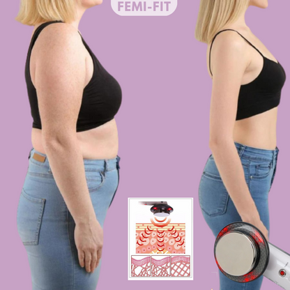 Avelena | 3-in-1 Tier- und Cellulite-Entferner - SlimShape