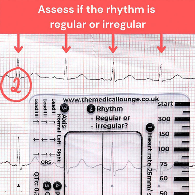 Avelena | ECG 7 Schritte Lineal