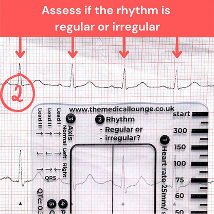 Avelena | ECG 7 Schritte Lineal