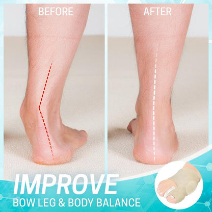 Avelena | Dr.Healthy Ballenzeh-Korrekturhülse