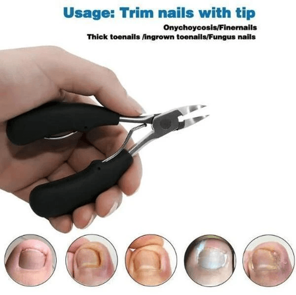 Avelena | Medizinische Nagelknipser