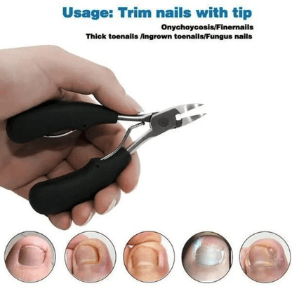 Avelena | Medizinische Nagelknipser