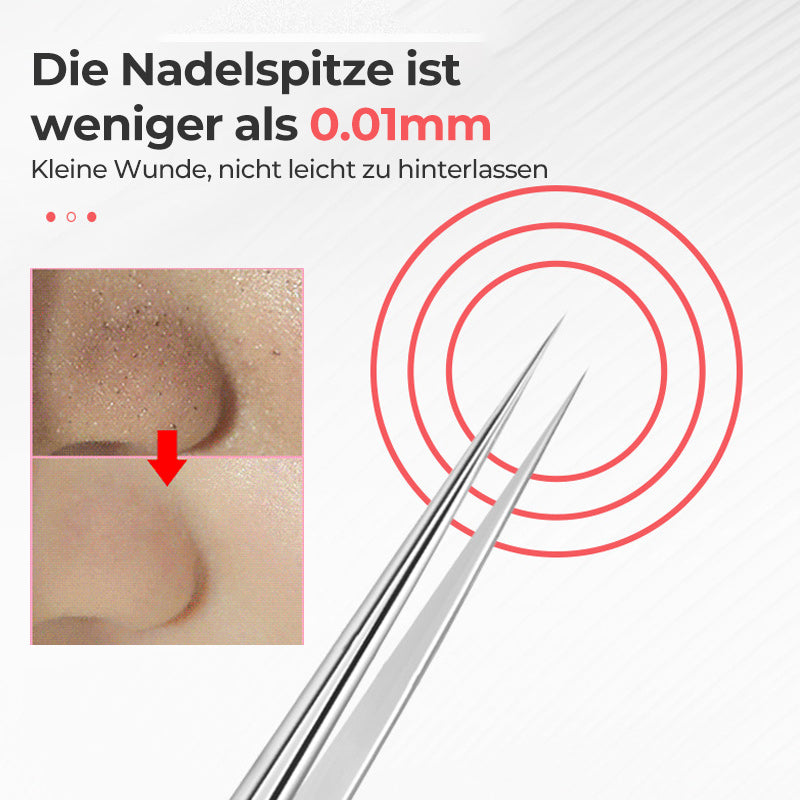 Avelena | Zange zum Entfernen von Mitessern im Gesicht