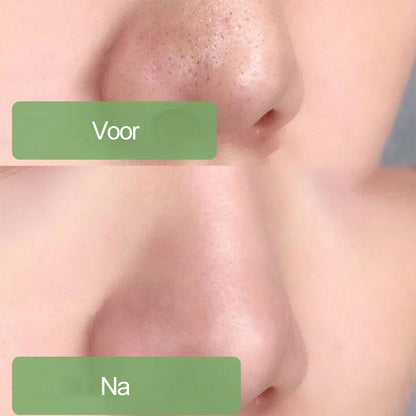 Avelena | Reinigung Maske