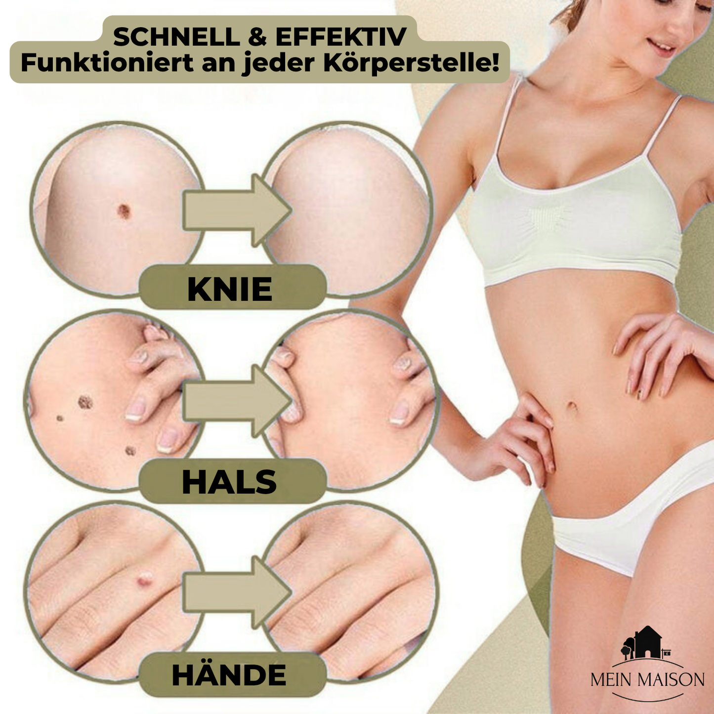 Avelena | Clarina SkinClear | Warzen- & Muttermalentferner | Sanft & Effektiv | Für Gesicht & Körper