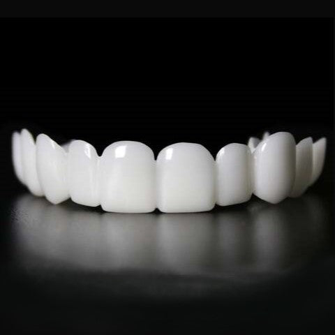 Avelena | Sofortige Lächelverwandlung mit Snap on Smile Veneers
