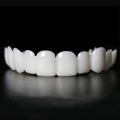 Avelena | Sofortige Lächelverwandlung mit Snap on Smile Veneers
