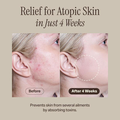 Avelena | Relief Schlammmaske