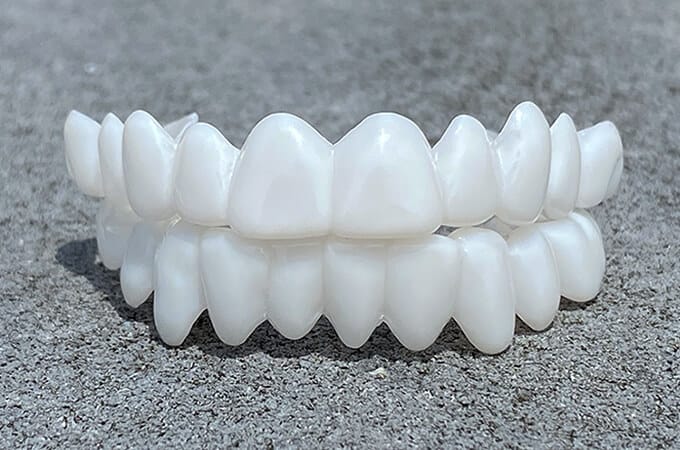 Avelena | Zahnprothese