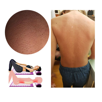 Avelena | Akupressur Yogamatte und Kissen Set