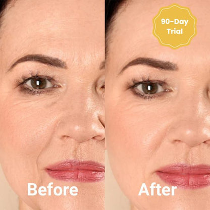 Avelena | DermaFaden Vollständiges Kollagen-Fadenlifting-Kit