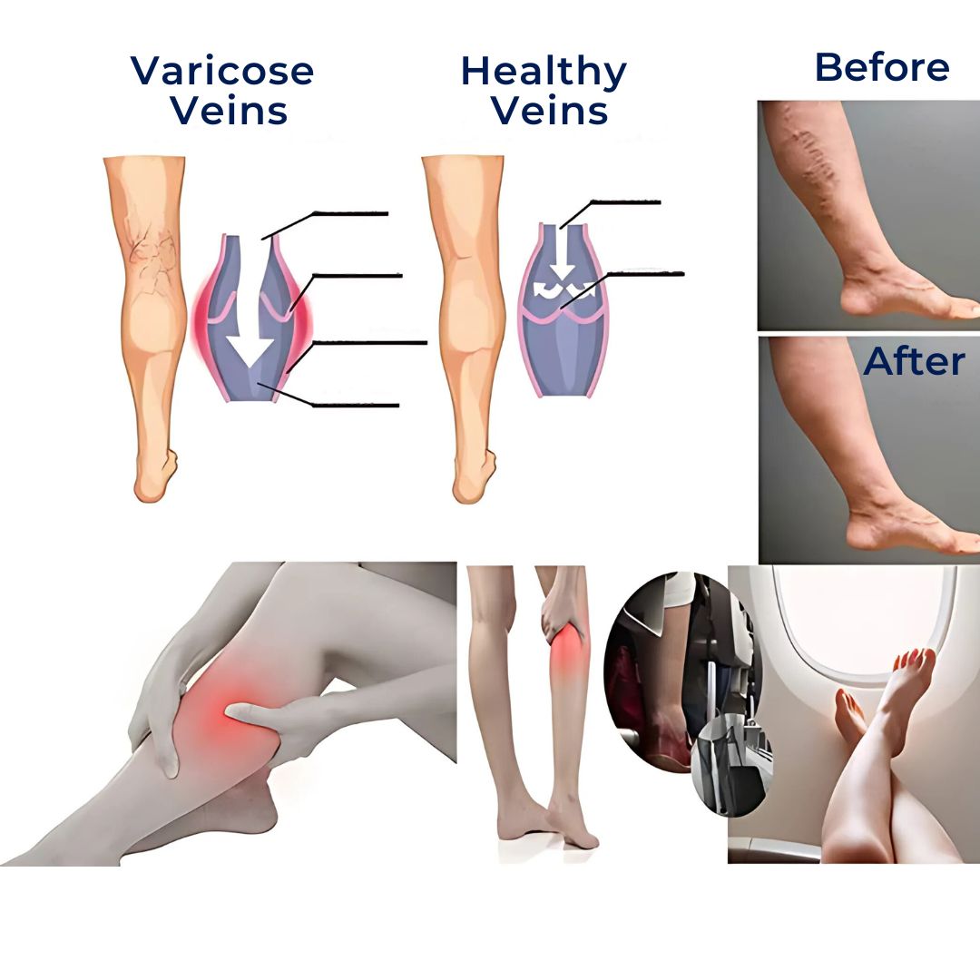 Avelena | CircuEase Kompressionsstrümpfe | Weiches, hoch elastisches Design für Muskelregeneration und Kreislaufverbesserung für Berufstätige auf den Beinen