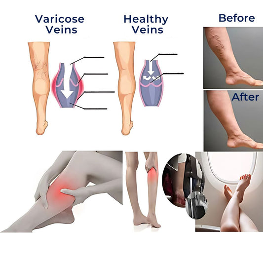 Avelena | CircuEase Kompressionsstrümpfe | Weiches, hoch elastisches Design für Muskelregeneration und Kreislaufverbesserung für Berufstätige auf den Beinen