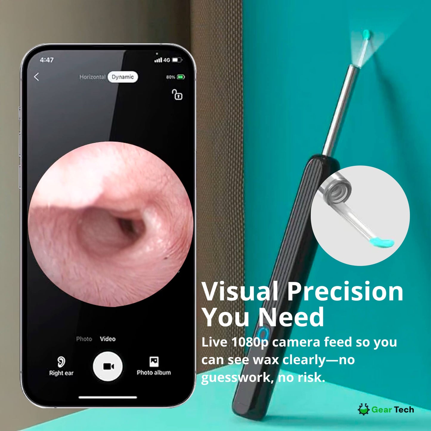 Avelena | EarScope Pro Ohrenwachsentfernungs-Kit | Hochauflösende Kamera & LED-Lichter für sicheren Gebrauch zu Hause