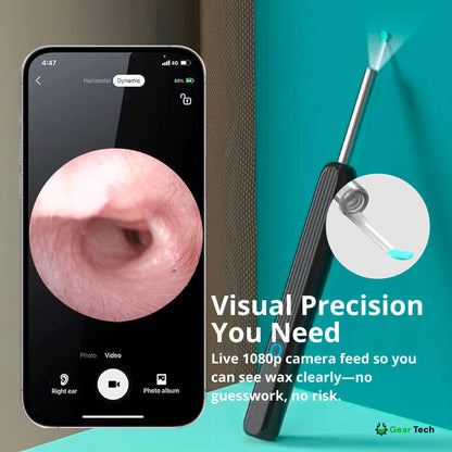 Avelena | EarScope Pro Ohrenwachsentfernungs-Kit | Hochauflösende Kamera & LED-Lichter für sicheren Gebrauch zu Hause