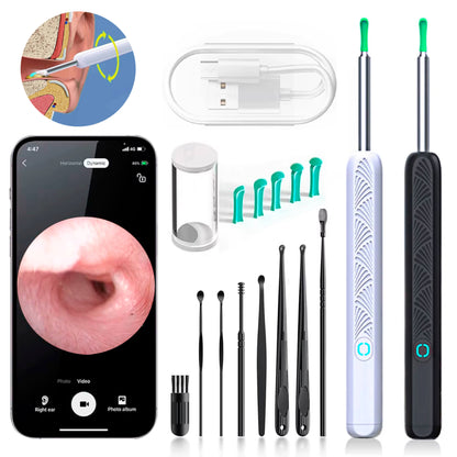 Avelena | EarScope Pro Ohrenwachsentfernungs-Kit | Hochauflösende Kamera & LED-Lichter für sicheren Gebrauch zu Hause
