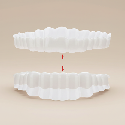 Avelena | On Smile Veneers Set | Temporäre Zahnverschönerung | Ober- & Unterkiefer