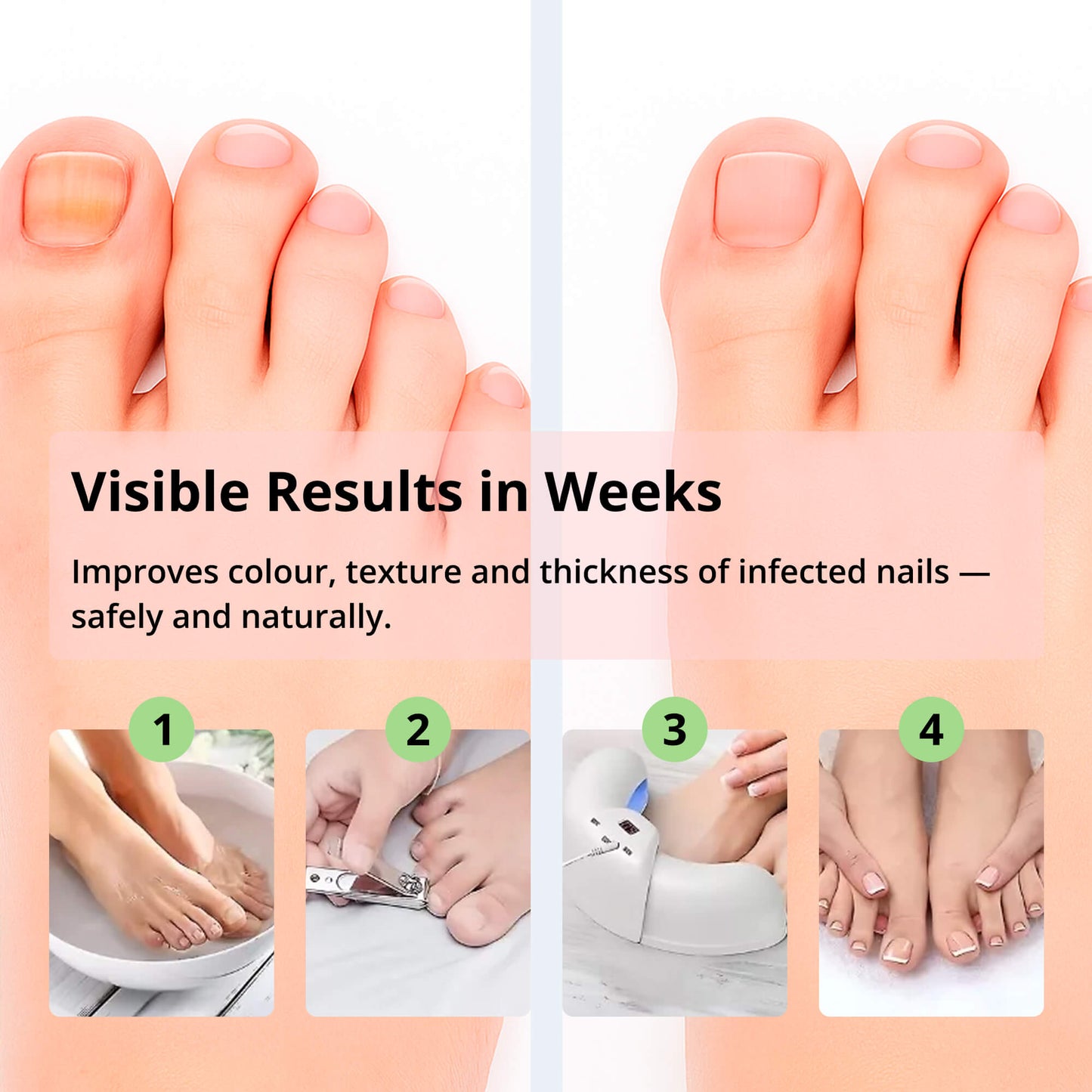 Avelena | ClearToe | Nagelbehandlung – Gesündere und schönere Nägel schnell