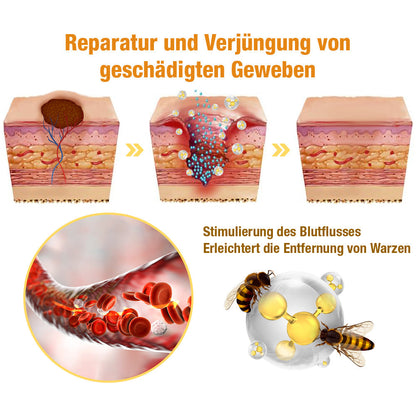 Avelena | Warzenentfernungsspray | Hauttag & Muttermal Pflege | Bienengift-Formel für sanfte Hautreinigung