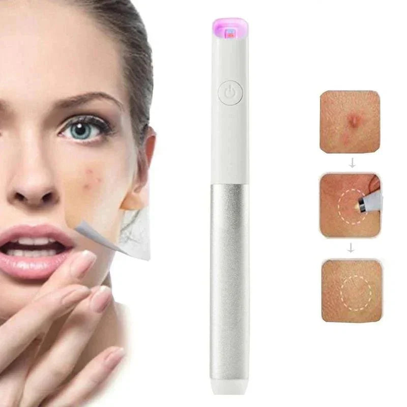 Avelena | Akne Lichttherapie Pen Kraftvolle Led Behandlung