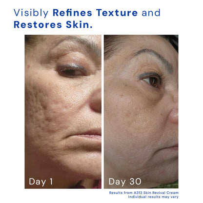 Avelena | AltersloseAusstrahlung Anti-Aging-Lösung für die Haut