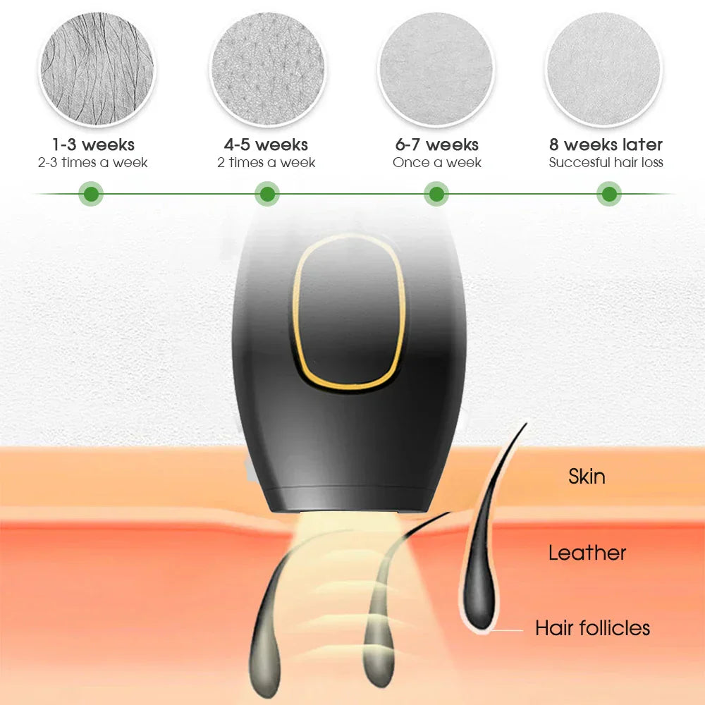 Avelena | Bikini IPL 500.000 Flash Epilierer Impulse Permanent Laser Epilierer Schmerzlos Für Frauen Haar Entfernung Heimgebrauch Geräte