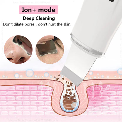 Avelena | Ultraschall Gesichts Scrubber Peeling Werkzeug