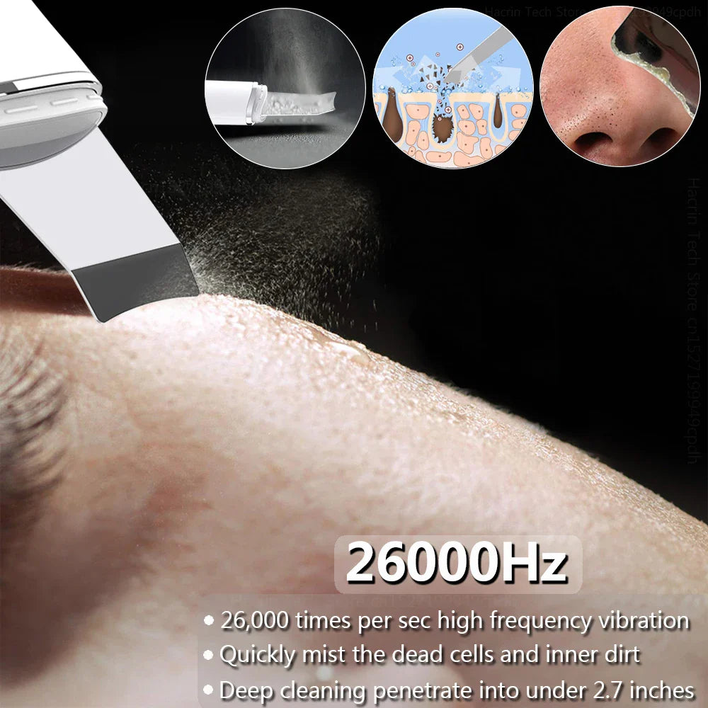 Avelena | Ultraschall Gesichts Scrubber Peeling Werkzeug