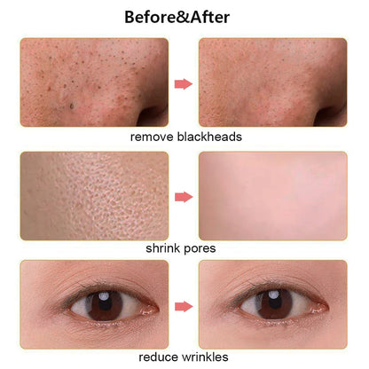 Avelena | Ultraschall Gesichts Scrubber Peeling Werkzeug