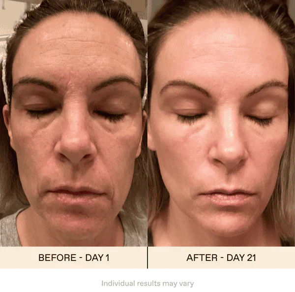 Avelena | AugeVerjüngen Magie der Augenwiederherstellung in nur wenigen Wochen