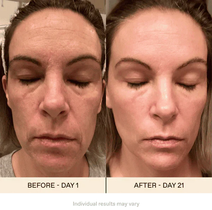 Avelena | AugeVerjüngen Magie der Augenwiederherstellung in nur wenigen Wochen