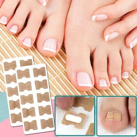 Avelena | ALIGNSTRIP – Schmerzfreie Nagelkorrekturstreifen für eingewachsene und deformierte Nägel