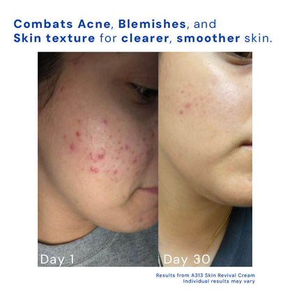 Avelena | AltersloseAusstrahlung Anti-Aging-Lösung für die Haut