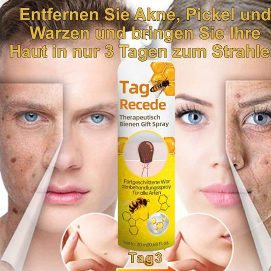 Avelena | Warzenentfernungsspray | Hauttag & Muttermal Pflege | Bienengift-Formel für sanfte Hautreinigung