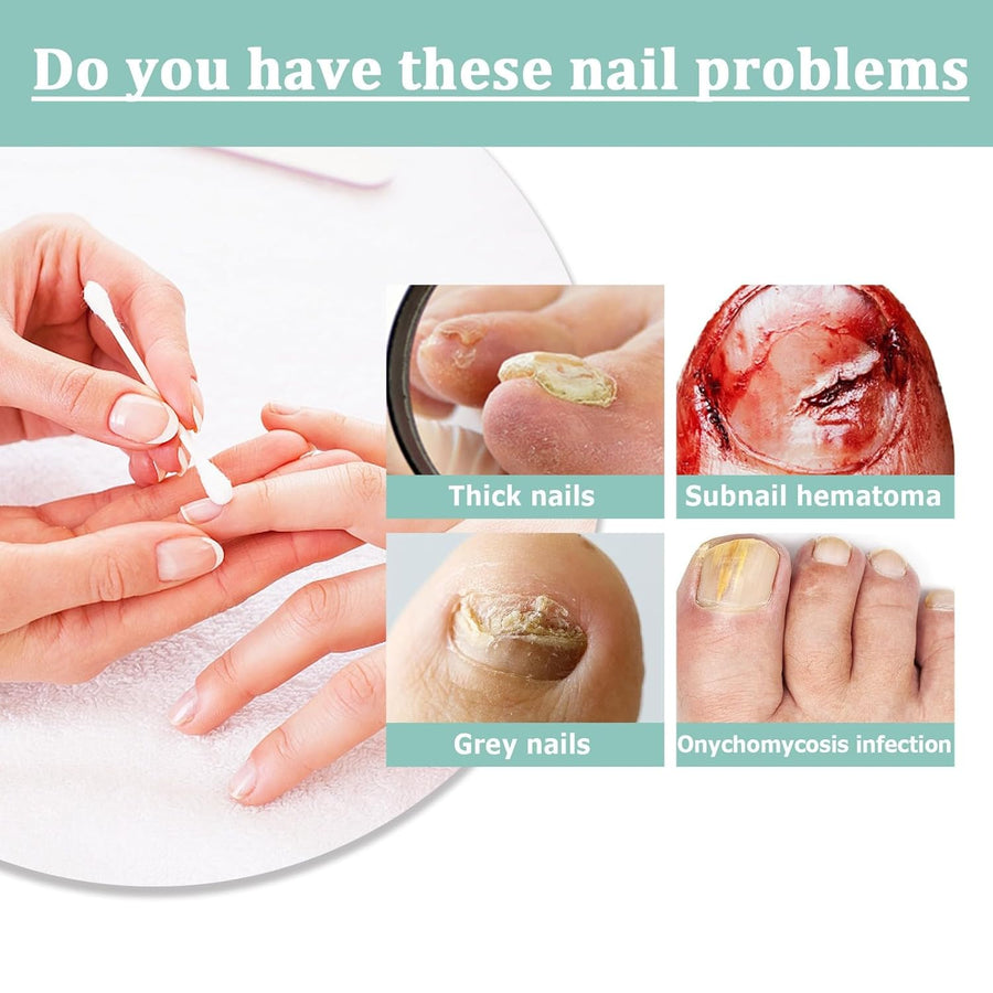 Avelena |  NailBloom – Sag brüchigen Nägeln für immer Lebewohl